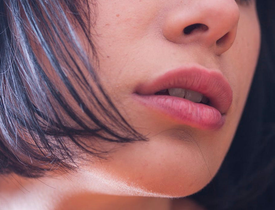 How To Heal And Prevent Chapped Lips Naturally?