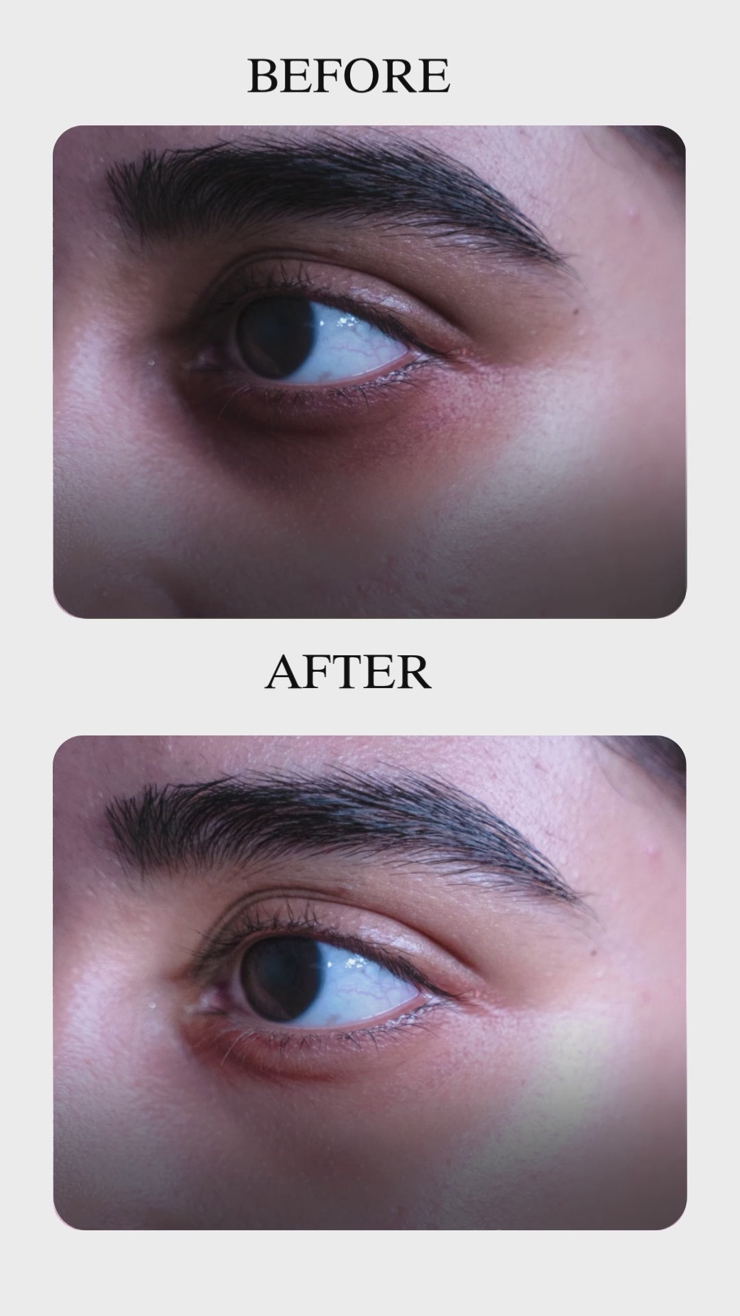 Under Eye Gel