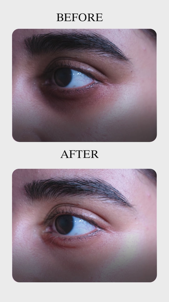 Under Eye Gel