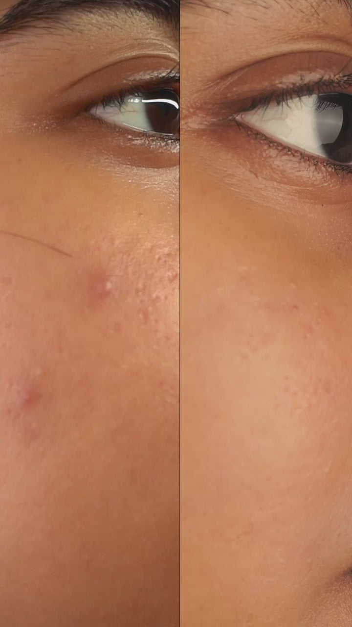 Ayurvedic Face Scrub